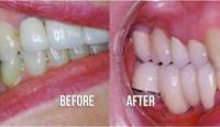 Grove City Dental image 17